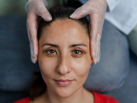 Does Eyelid Surgery Work for Puffy Lower Lids?