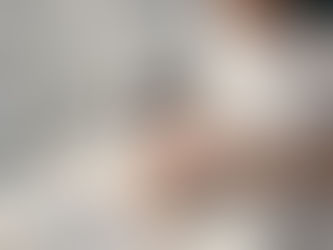 Is a Chemical Peel Safe for Dark Skin Tones?