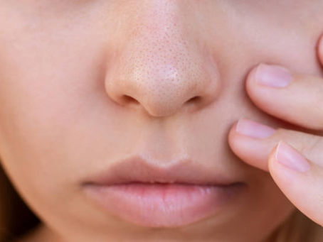 Is Rhinoplasty Recommended for Teen Patients?