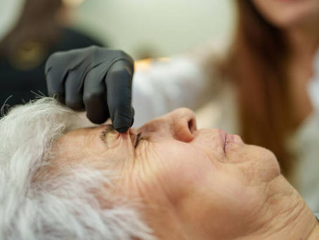 Eyelid Surgery: A Quick Solution for Tired Eyes