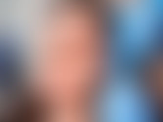 Do Under Eye Fillers Look Natural?