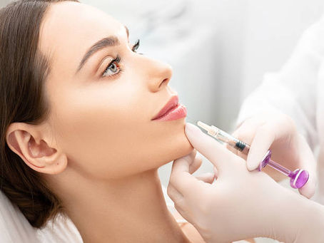 Are Russian Lip Fillers Best for Subtle Results?