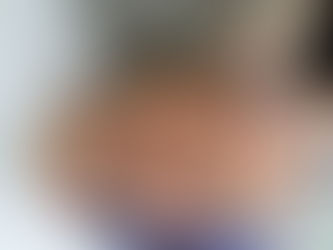 HydraFacial Treatment: The Treatment Your Skin Deserves