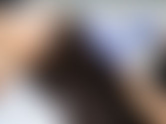 Does PRP Hair Treatment Work on Receding Hairline?