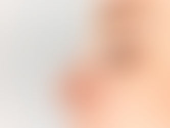 Is Rhinoplasty Customizable for Ethnic Features?