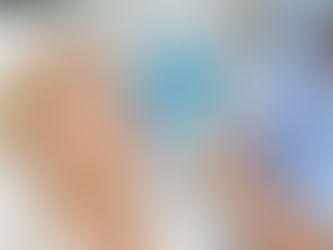 What Age Should You Start Getting Botox?