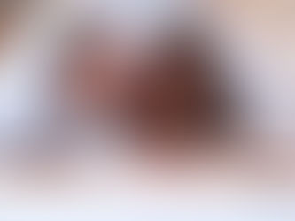 How P-Shot Injections Improve Men’s Health