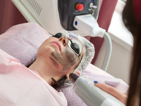 Laser Carbon Peel: Reboot Your Skin’s Natural Glow