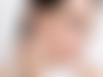 Does Botox Injection Last for a Long Time?