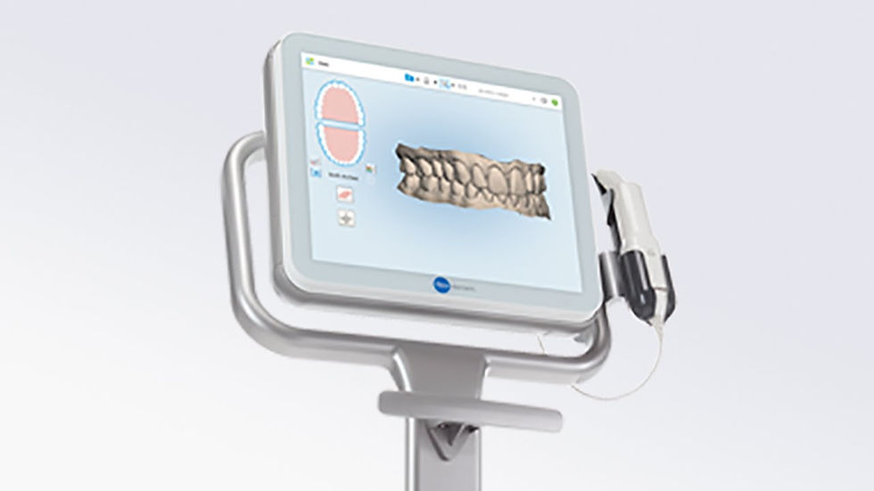 iTero 3D Scanner Image