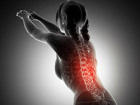 (Unilateral Biportal Endoskopik) UBE Omurga Cerrahisi Nedir?