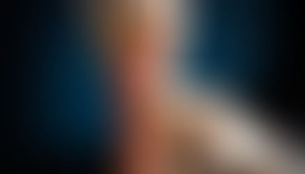 El Bileği Artroskopi Ameliyatı