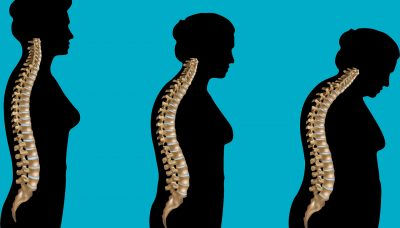 Kifoplasti-Vertebroplasti Farkı Nedir?