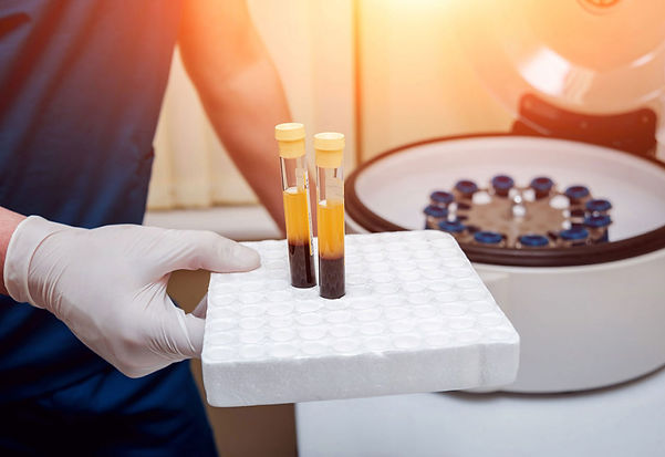 prp hair treatment
