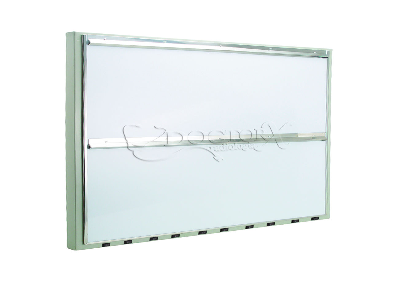 Negatoscópio de Sobrepor 5 sobre 5 Corpos