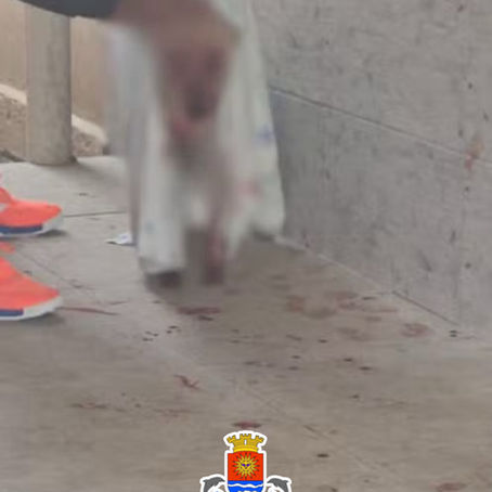 CADELA É ATACADA POR AMERICAN BULLY PELO PORTÃO DE CASA E INTERNADA DE GUARUJÁ
