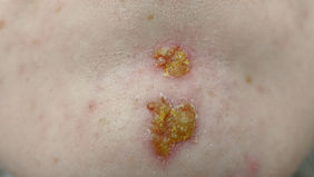 infectious diseases.jpeg