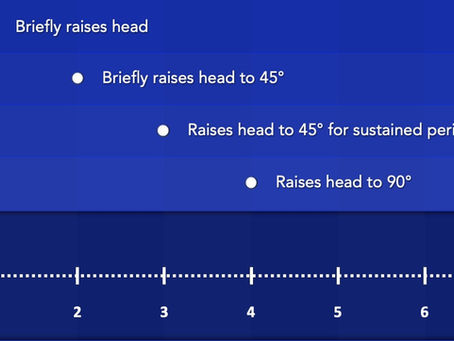 Head Control - Developmental Milestones