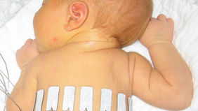 neonatology.jpeg