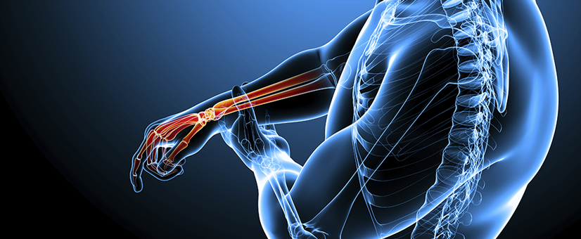 center for orthopedic excellence center for orthopedic excellence