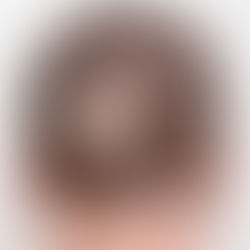 Homeopathy Doctor for Alopecia Chennai Tamilnadu