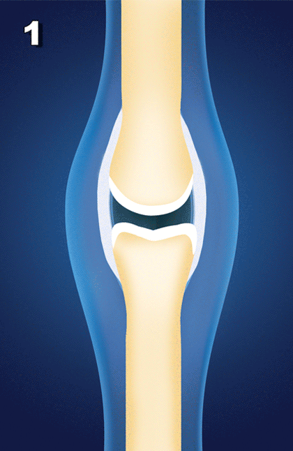 Homeopathy Doctor for Fibromyalgia in Chennai