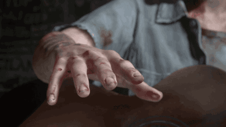 Homeopathy Doctor for Parkinson’s disease in Chennai