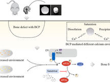 eIF2α–ATF4 Pathway Activated by a Change in the Calcium Environment Participates in BCP-Mediated BTE