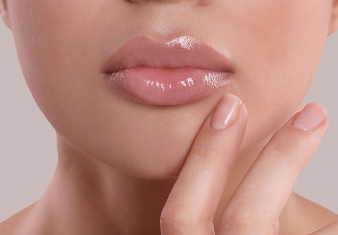 Lip filler at Aesthetic Astute, Peregian Springs, Cosmetic Doctor Sunshine Coast