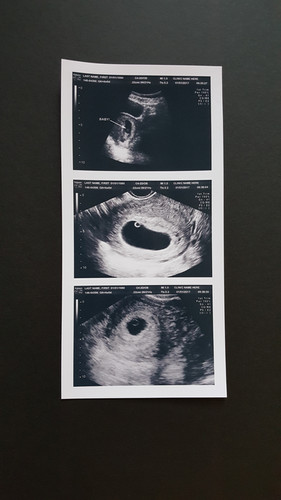 CUSTOM 2D PRANK PREGNANCY FAKE ULTRASOUND SONOGRAM STRIP - 3 PHOTOS