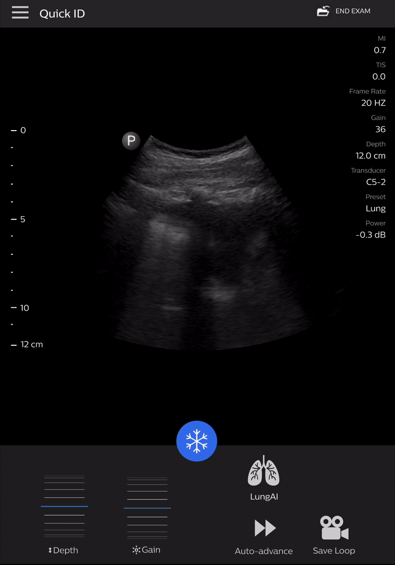 LungPanel_Animation.gif