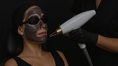 Carbon Laser Peel.jpg