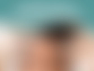 Toxina Botulínica: tudo o que você precisa saber antes de fazer!