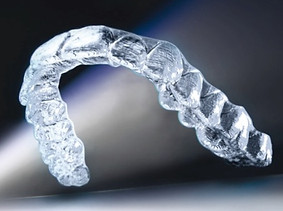 aligneur-gouttiere-transparent-invisalig