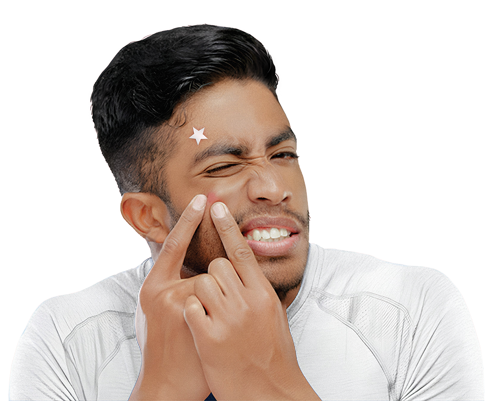 Young man squeezing a pimple with acne patches on his face at The Acne Clinic in i12 Katong Singapore.