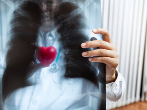 The heart disease risk factors that matter most and what you can change