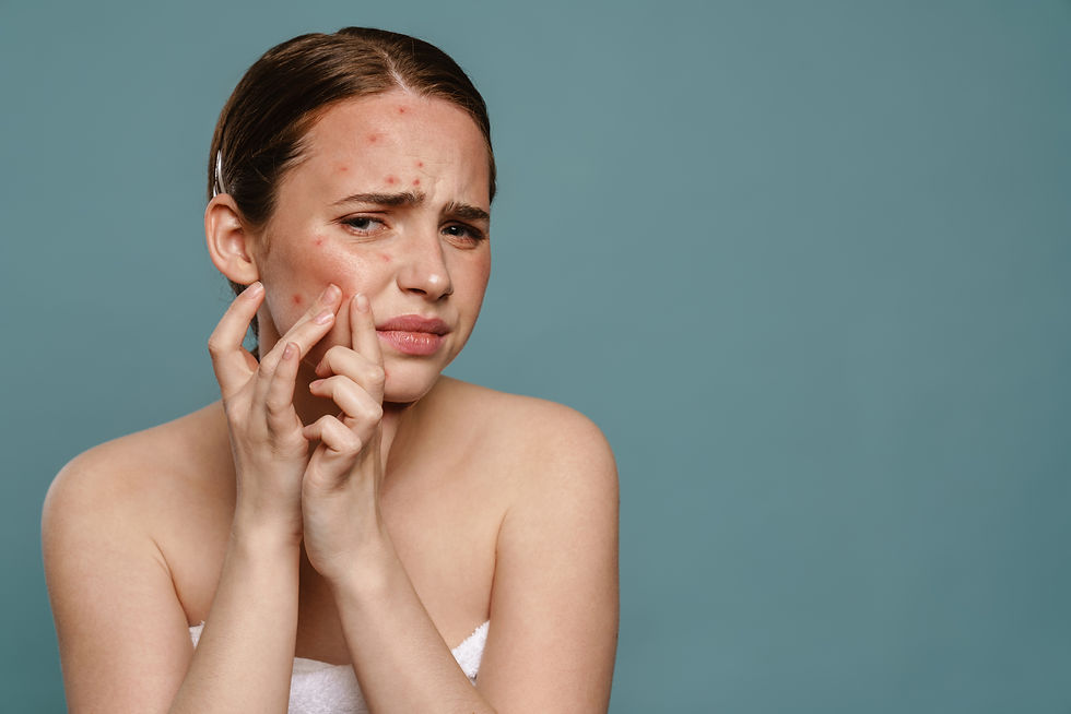 A person with acne examines their skin with concern against a plain blue background. They're touching their face, conveying unease.