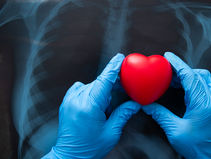 Can cardiac screening detect all heart problems and what are its limits