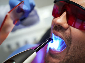 What Can Laser Dentistry Be Used For in Dental Treatment?