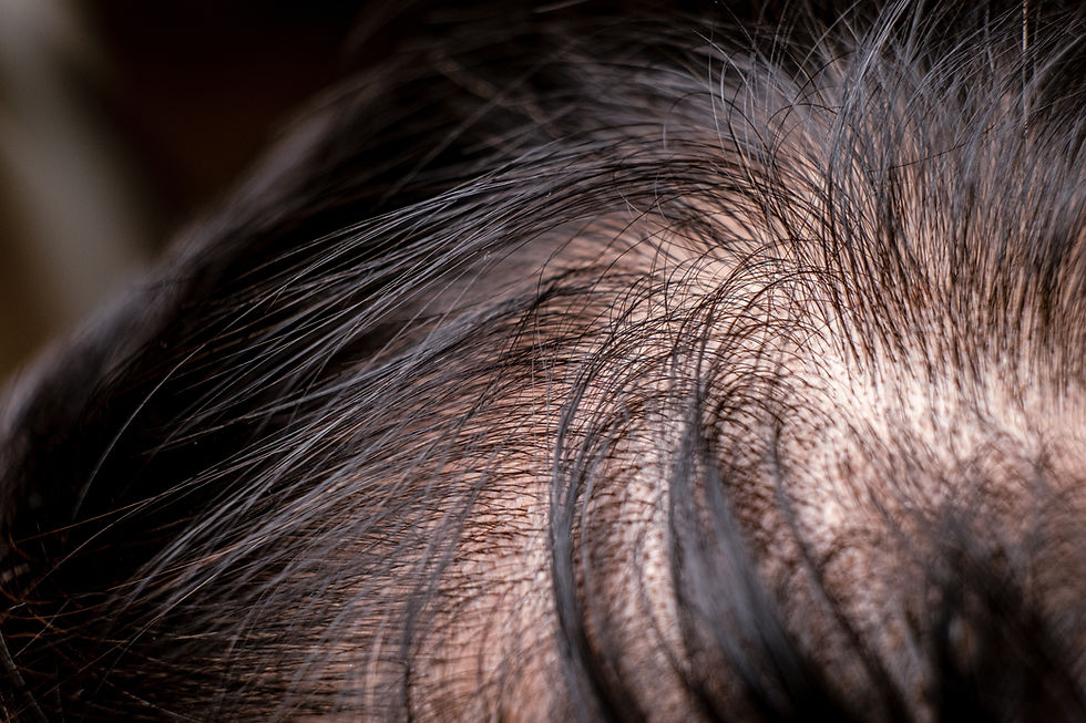 Close-up aof a person's scalp with thinning dark hair, showing skin and hair details. The mood is neutral, focused on hair texture.