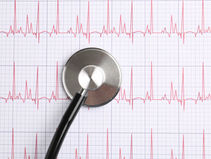 Can an ECG Test tell if your heart is healthy and what it cannot confirm