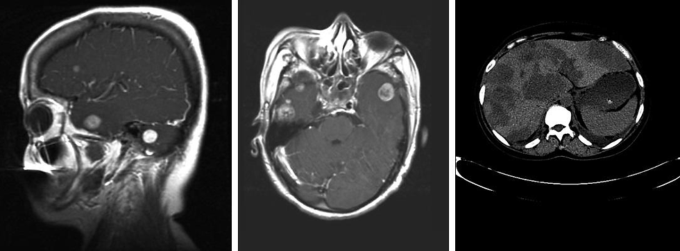 Three MRI scans: side, top view of a brain in black and white, and an abdominal scan. Highlighted areas suggest medical interest.