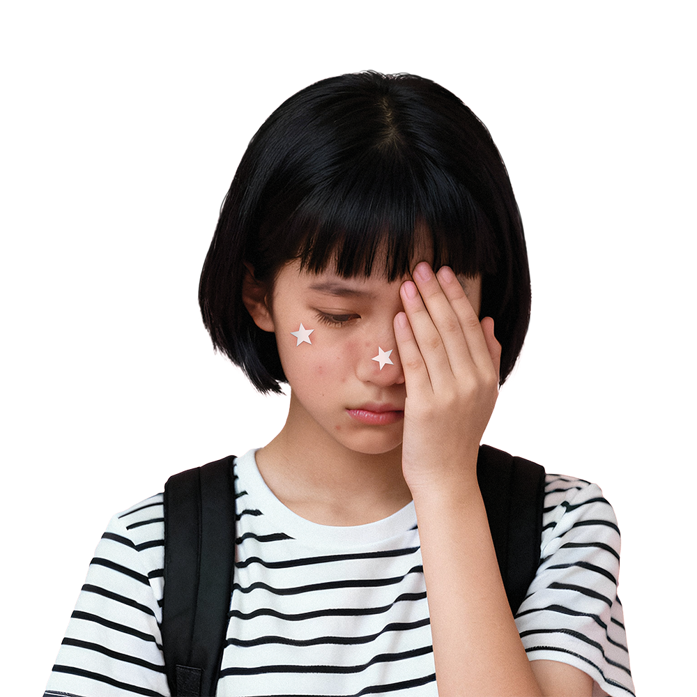 Young girl with acne patches on her face touching her eye looking upset at The Acne Clinic in i12 Katong Singapore.