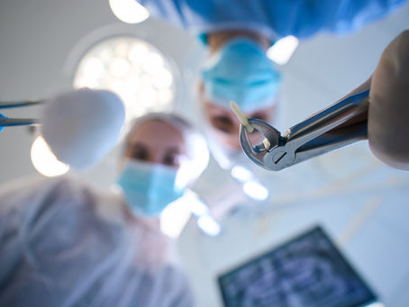 What Is Crown Lengthening and When Is It Recommended?