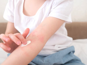 When Is Atopic Dermatitis No Longer Controlled by Creams Alone?