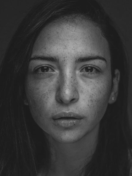 beautifull portrait of woman with freckles, black and white
