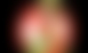 ЗДОРОВЬЕ ДЕТЕЙ Здоровье детей. Агрессия паразитов