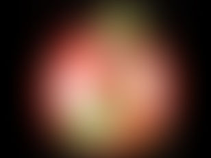 ЗДОРОВЬЕ ДЕТЕЙ Здоровье детей. Агрессия паразитов