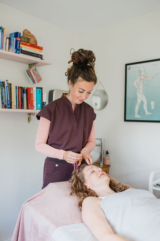 acupuncturist practicing acupuncture with a patient needling a point in Bexhill