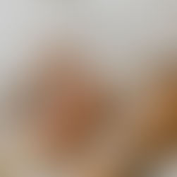 Chile fue elegido el primer mercado latinoamericano para innovadora tecnología especializada en cirugía cardíaca